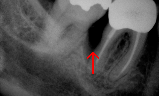 Before treatment