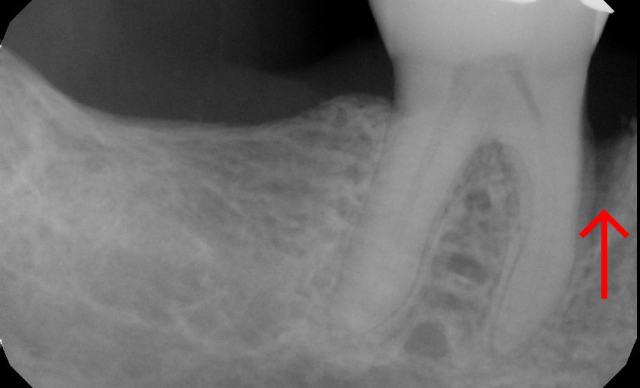 Before treatment