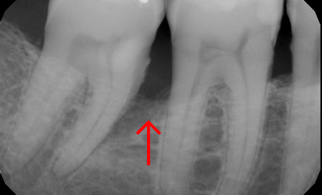 Before treatment
