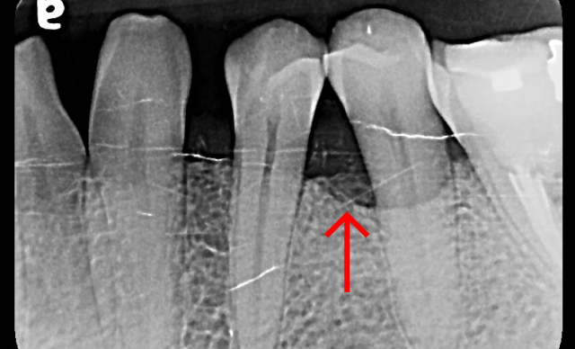 Before treatment