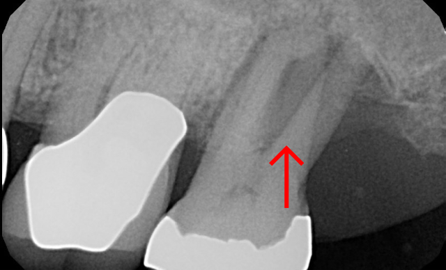 Before treatment