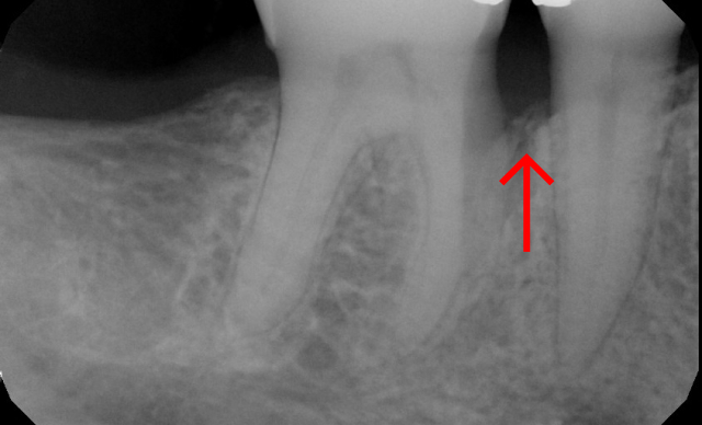 After treatment