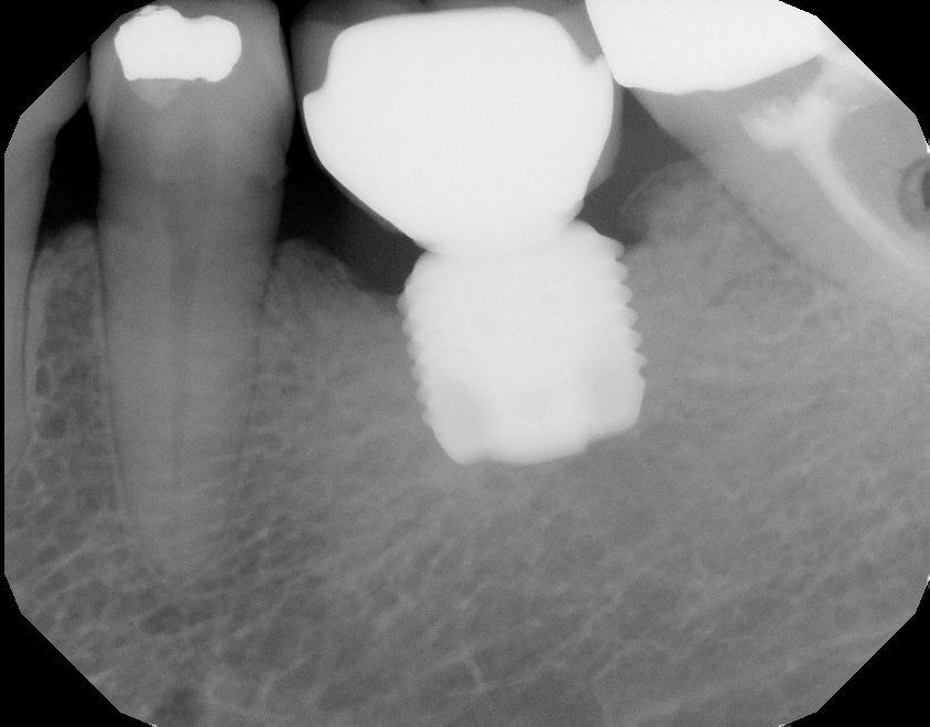 After treatment