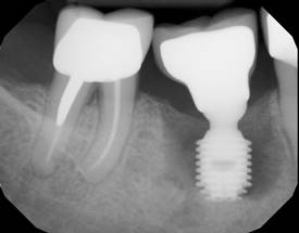 Before treatment
